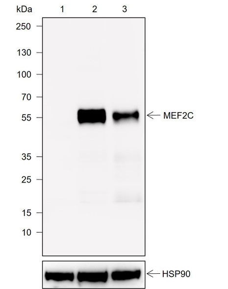 Recombinant MEF2C Monoclonal Antibody (AGEL6967)
