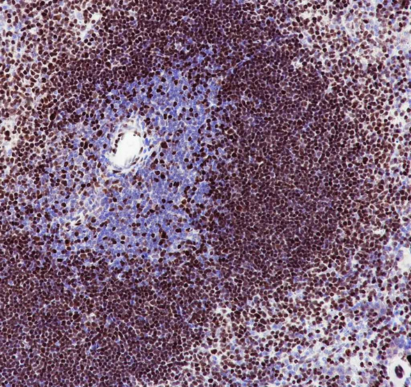 Recombinant MEF2C Monoclonal Antibody (AGEL6967)
