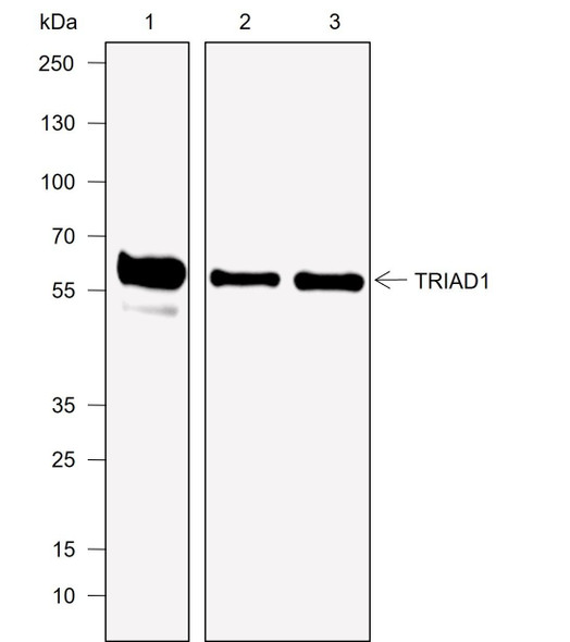 Recombinant TRIAD1 Monoclonal Antibody (AGEL6969)