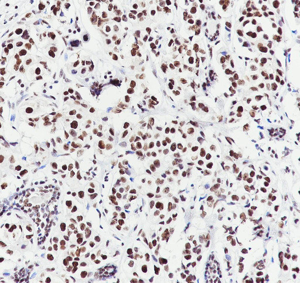 Recombinant MORF4L2 Monoclonal Antibody (AGEL6975)