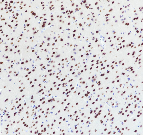 Recombinant U2AF2 Monoclonal Antibody (AGEL6984)