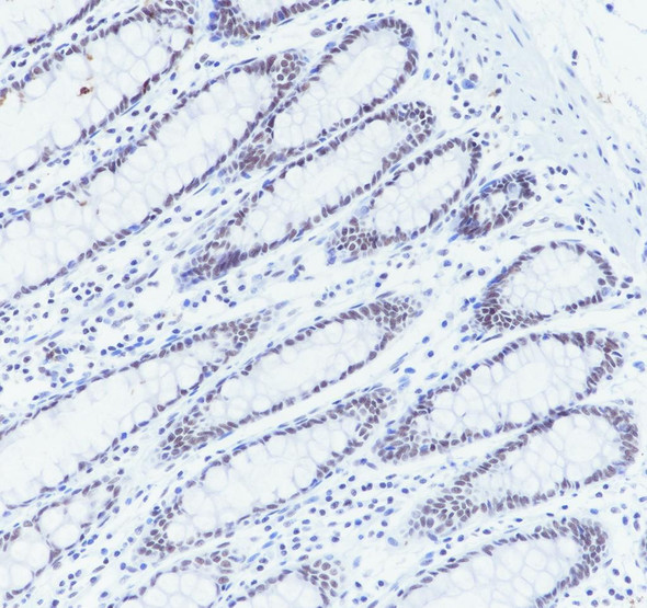Recombinant SIN3A Monoclonal Antibody (AGEL6985)