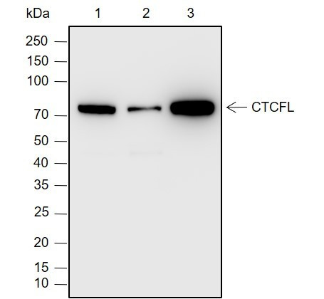 Recombinant CTCFL Monoclonal Antibody (AGEL6987)