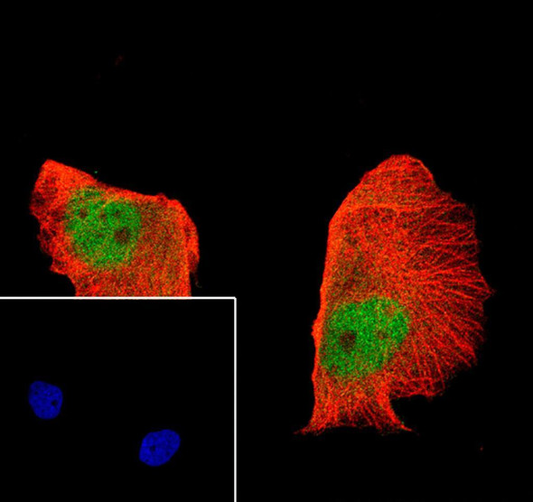 Recombinant MCM7 Monoclonal Antibody (AGEL6988)