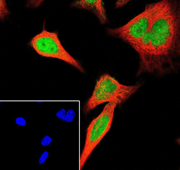 Recombinant MCM7 Monoclonal Antibody (AGEL6988)