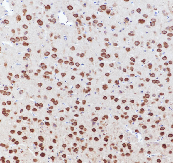 Recombinant CSDE1 Monoclonal Antibody (AGEL6990)