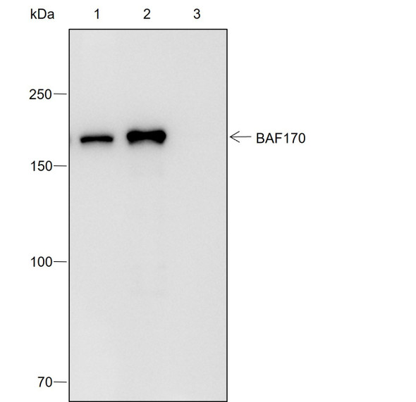 Recombinant SMARCC2/BAF170 Monoclonal Antibody (AGEL6991)