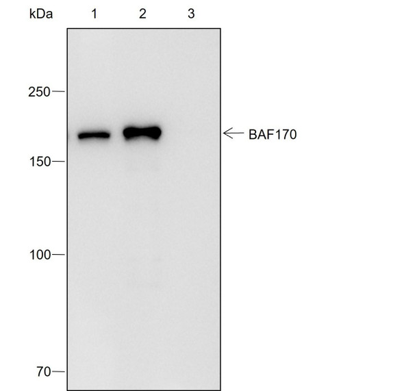 Recombinant SMARCC2/BAF170 Monoclonal Antibody (AGEL6991)