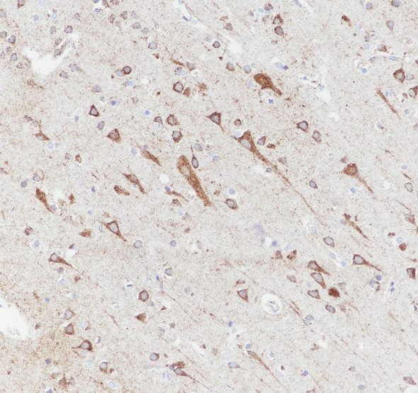 Recombinant eIF4A2 Monoclonal Antibody (AGEL6994)