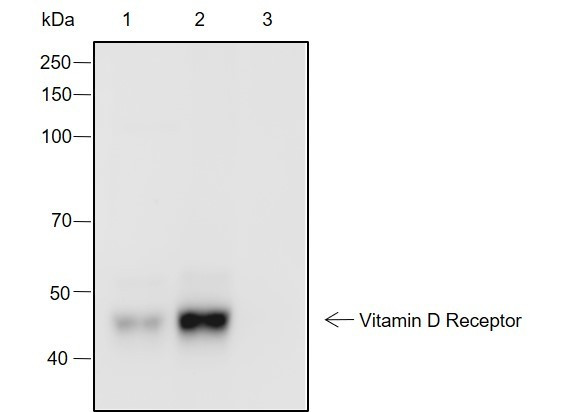 Recombinant Vitamin D Receptor Monoclonal Antibody (AGEL6995)