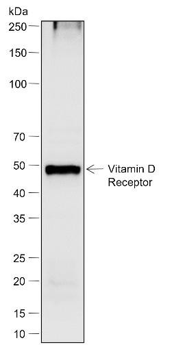 Recombinant Vitamin D Receptor Monoclonal Antibody (AGEL6995)