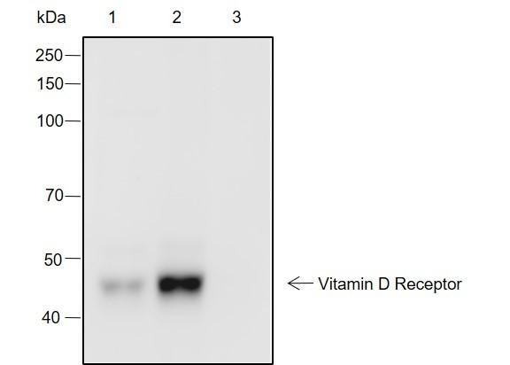 Recombinant Vitamin D Receptor Monoclonal Antibody (AGEL6995)