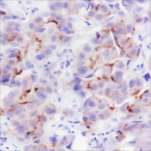 Recombinant Phospho-Girdin (Tyr1765) Monoclonal Antibody (AGEL7000)