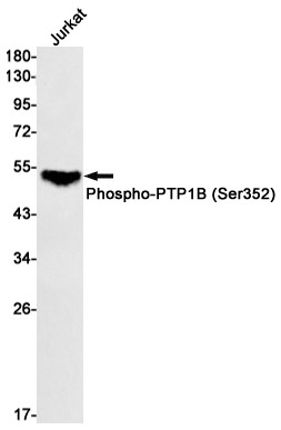 Recombinant Phospho-PTP1B (Ser352) Monoclonal Antibody (AGEL7003)