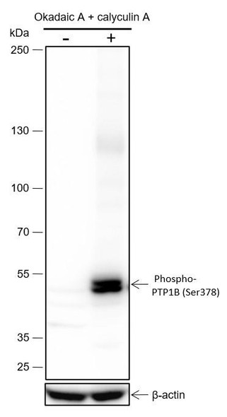Recombinant Phospho-PTP1B (Ser378) Monoclonal Antibody (AGEL7007)