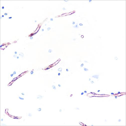 Recombinant Claudin-5 Monoclonal Antibody (AGEL7008)