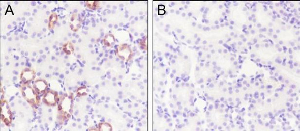 Recombinant Phospho-IKB alpha (Ser32, Ser36) Monoclonal Antibody (AGEL7009)