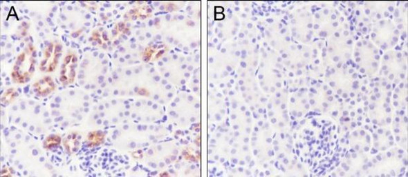 Recombinant Phospho-IKB alpha (Ser32, Ser36) Monoclonal Antibody (AGEL7009)