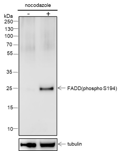 Recombinant Phospho-FADD (S194) Monoclonal Antibody (AGEL7010)