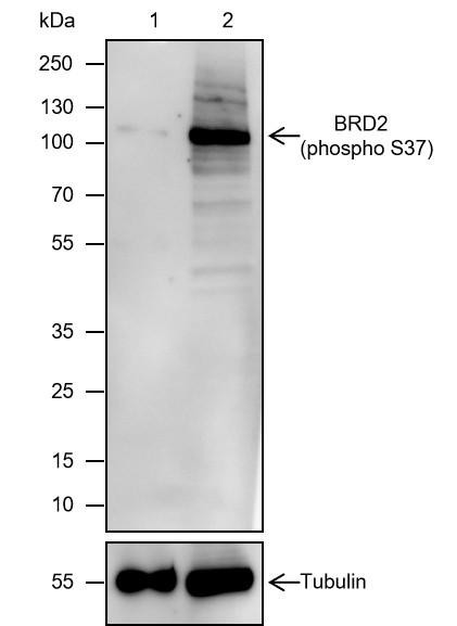 Recombinant Phospho-BRD2 (S37) Monoclonal Antibody (AGEL7011)