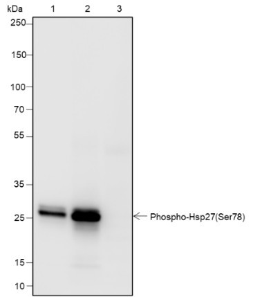 Recombinant Phospho-HSP27 (Ser78) Monoclonal Antibody (AGEL7013)