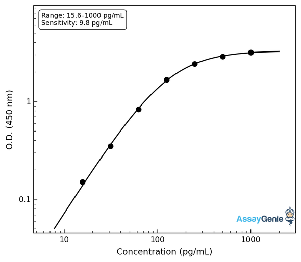 Human Sphingosine kinase 1 (SPHK1) ELISA Kit (HUEB2221)