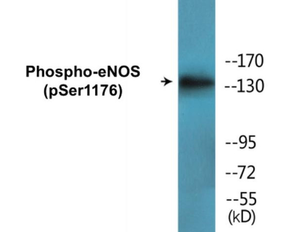 eNOS Phospho-Ser1176 Colorimetric Cell-Based ELISA Kit