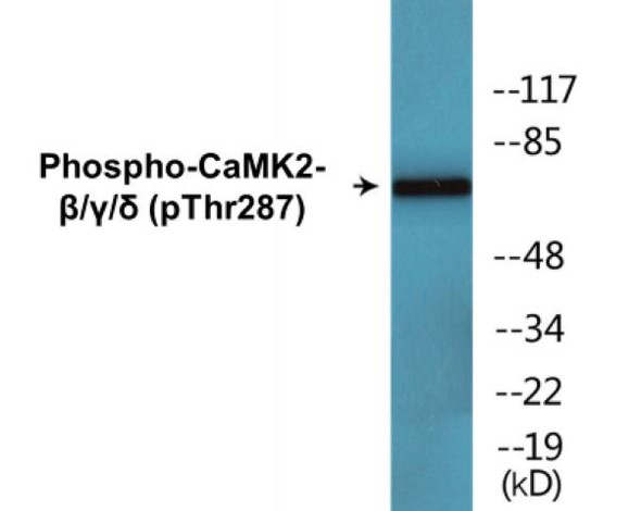 CaMK2-beta/gamma/delta Phospho-Thr287 Colorimetric Cell-Based ELISA Kit