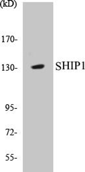 Cell Death SHIP1 Colorimetric Cell-Based ELISA Kit