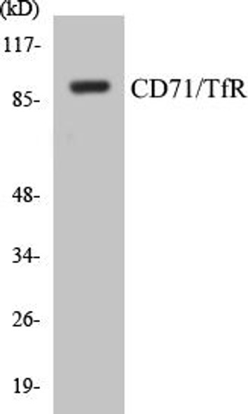 Cell Biology CD71/TfR Colorimetric Cell-Based ELISA Kit