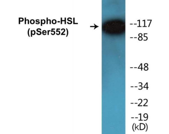 HSL Phospho-Ser552 Colorimetric Cell-Based ELISA Kit