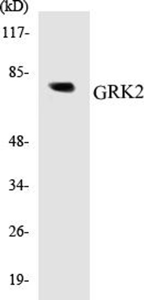 GRK2 Colorimetric Cell-Based ELISA Kit