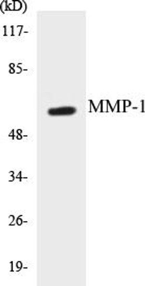 Cell Biology MMP-1 Colorimetric Cell-Based ELISA Kit