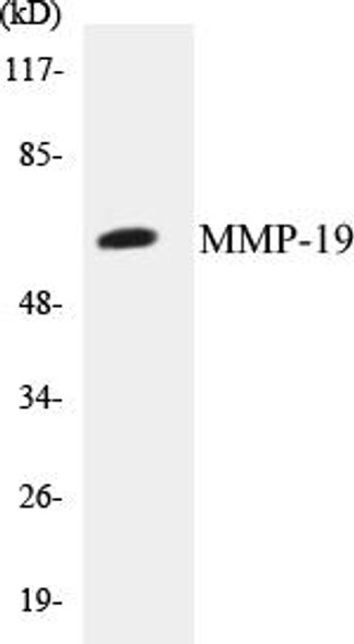 Cardiovascular MMP-19 Colorimetric Cell-Based ELISA Kit