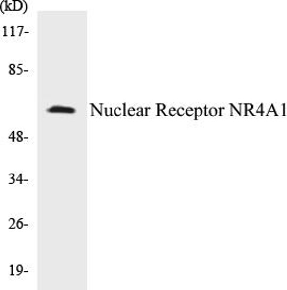 Epigenetics and Nuclear Signaling Nuclear Receptor NR4A1 Colorimetric Cell-Based ELISA Kit