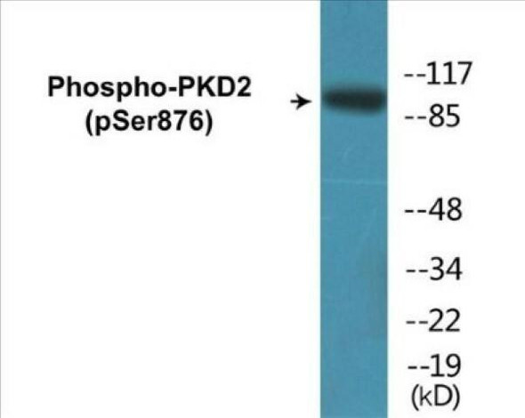 PKD2 Phospho-Ser876 Colorimetric Cell-Based ELISA Kit
