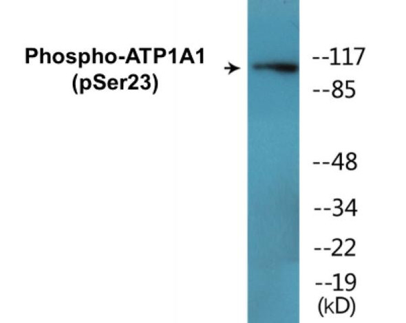 ATP1A1 Phospho-Ser23 Colorimetric Cell-Based ELISA Kit