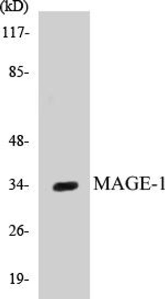 Epigenetics and Nuclear Signaling MAGE-1 Colorimetric Cell-Based ELISA Kit