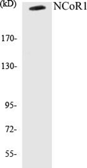 Cell Biology NCoR1 Colorimetric Cell-Based ELISA Kit