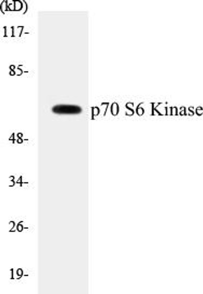 Cell Death p70 S6 Kinase Colorimetric Cell-Based ELISA Kit