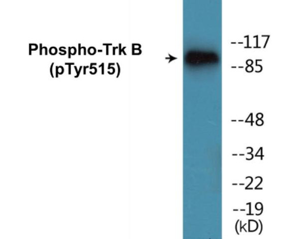 Trk B Phospho-Tyr515 Colorimetric Cell-Based ELISA Kit