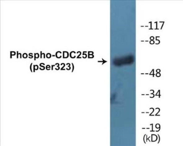 CDC25B Phospho-Ser323 Colorimetric Cell-Based ELISA Kit