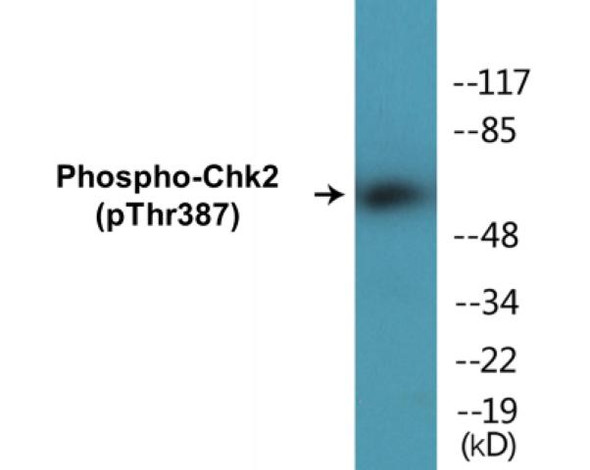 Chk2 Phospho-Thr387 Colorimetric Cell-Based ELISA Kit
