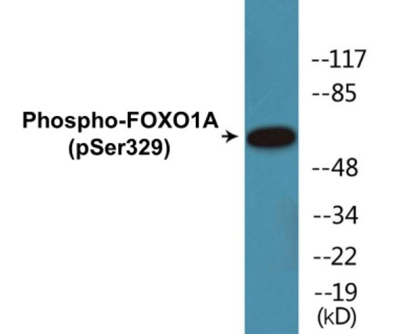 FOXO1A Phospho-Ser329 Colorimetric Cell-Based ELISA Kit