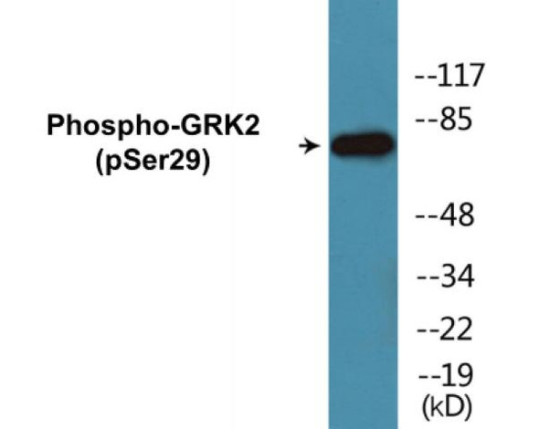 GRK2 Phospho-Ser29 Colorimetric Cell-Based ELISA Kit