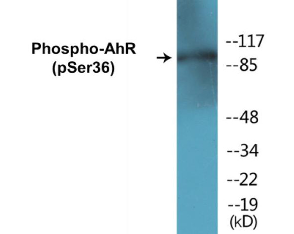 AhR Phospho-Ser36 Colorimetric Cell-Based ELISA Kit