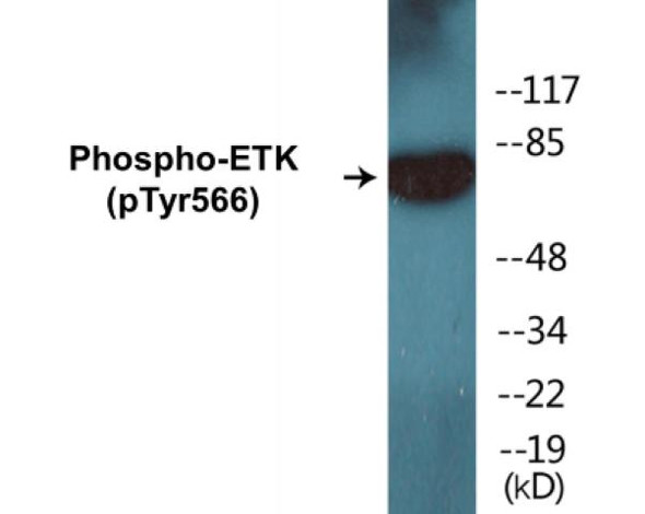 ETK Phospho-Tyr566 Colorimetric Cell-Based ELISA Kit