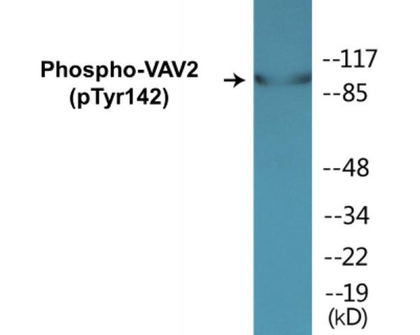 VAV2 Phospho-Tyr142 Colorimetric Cell-Based ELISA Kit