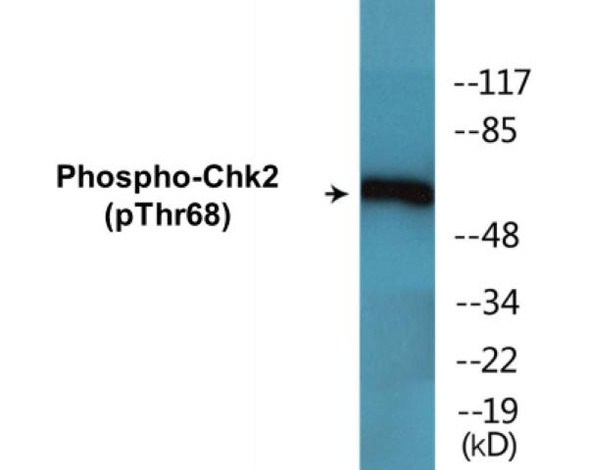 Chk2 Phospho-Thr68 Colorimetric Cell-Based ELISA Kit