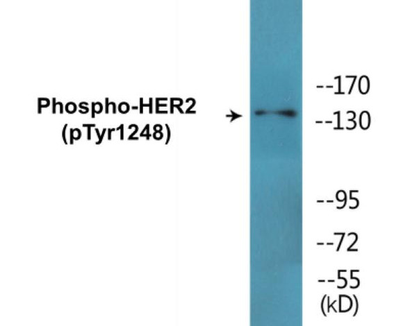 HER2 Phospho-Tyr1248 Colorimetric Cell-Based ELISA Kit